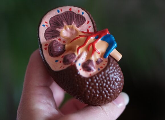 Oxalates in Chaga and how they affect your kidneys chaga kidneys health